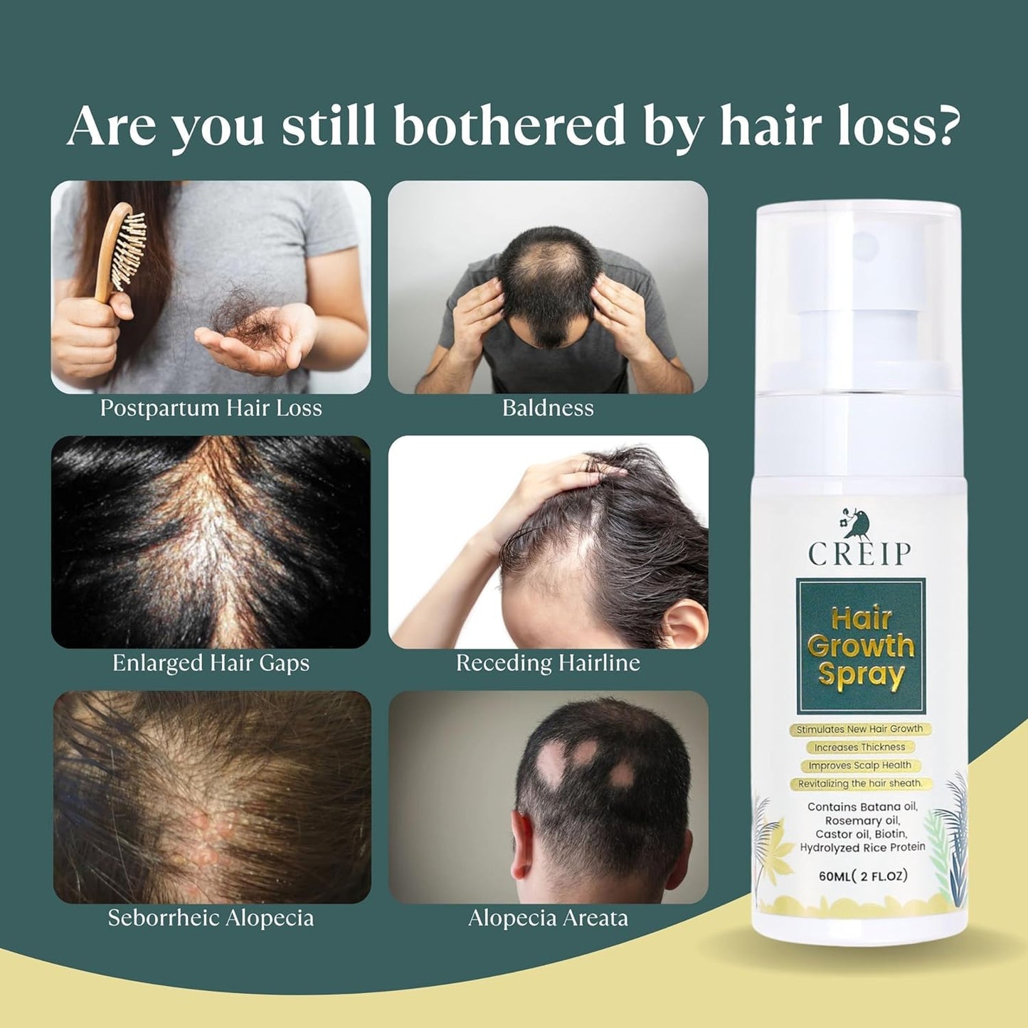 OG Hair Growth Spray, 2 FL OZ: Natural Formula with Batana, Castor and Rosemary Oil, Rice Water, and Biotin for Women and Men - Stimulates Hair Follicles & Promotes Hair Thickening