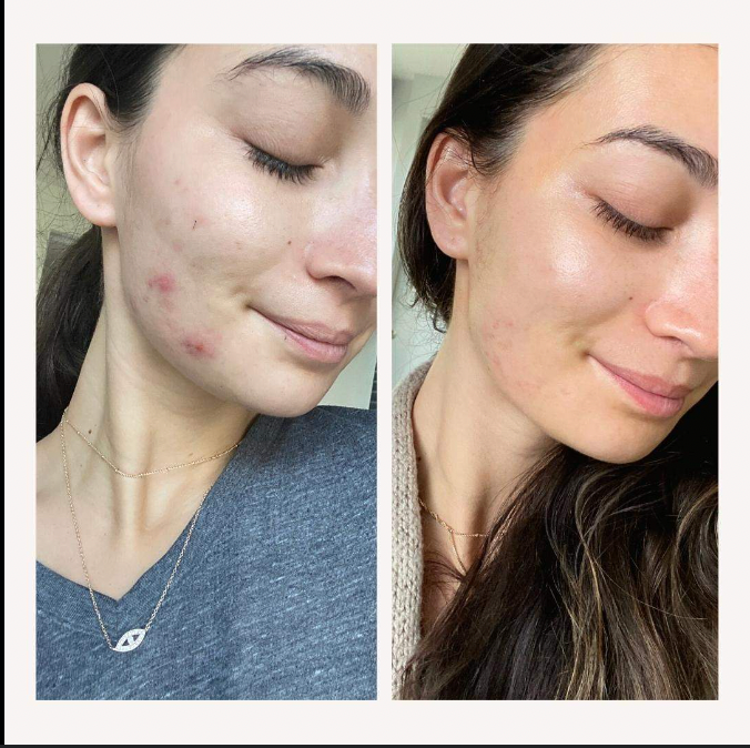 Hyaluronic Cleanser