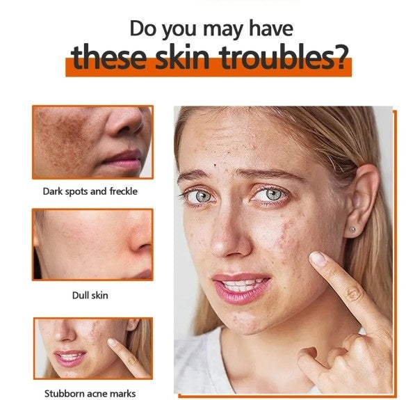 Kojic Acid Soap Skin Cleaning Facial Soap - EZ Beauty Lashes