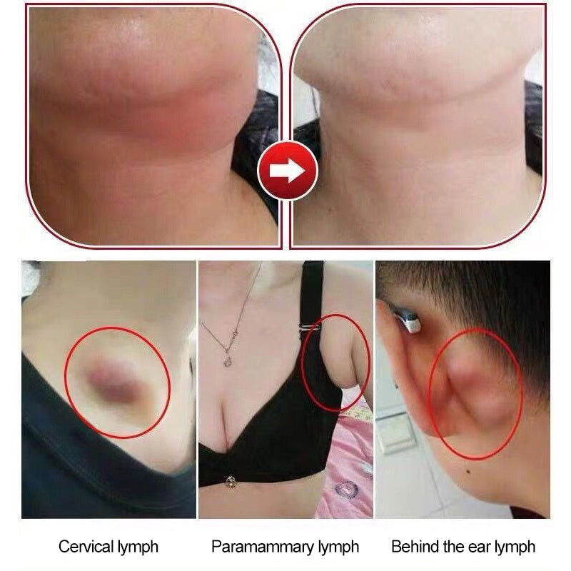 Lymphatic health stickers - EZ Beauty Lashes