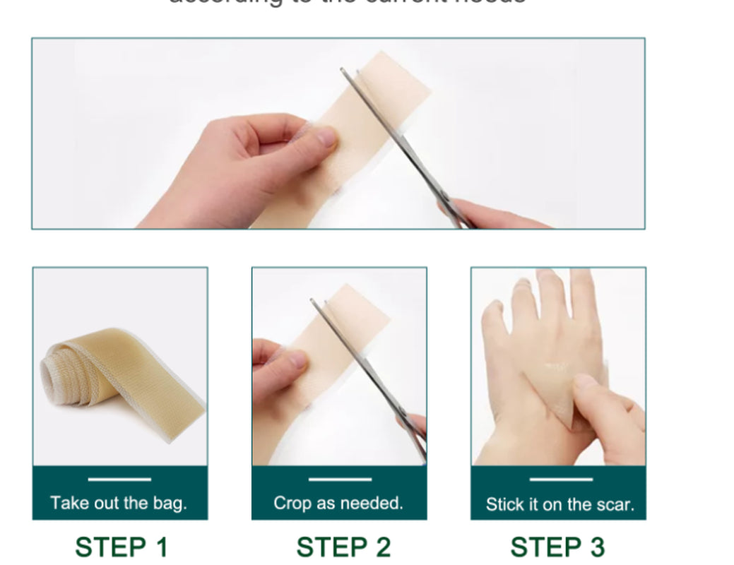 Silicone Gel Patch Removal Scar Stickers Medical Treatment Sheet Tape