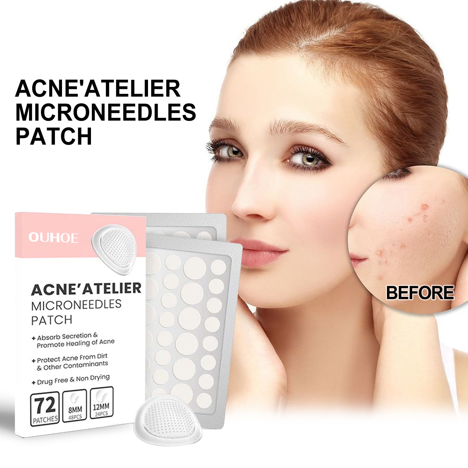 OUHOE Acne Patch Repair Acne Acne Redness Pore Cleansing & Moisturizing Patch - EZ Beauty Lashes