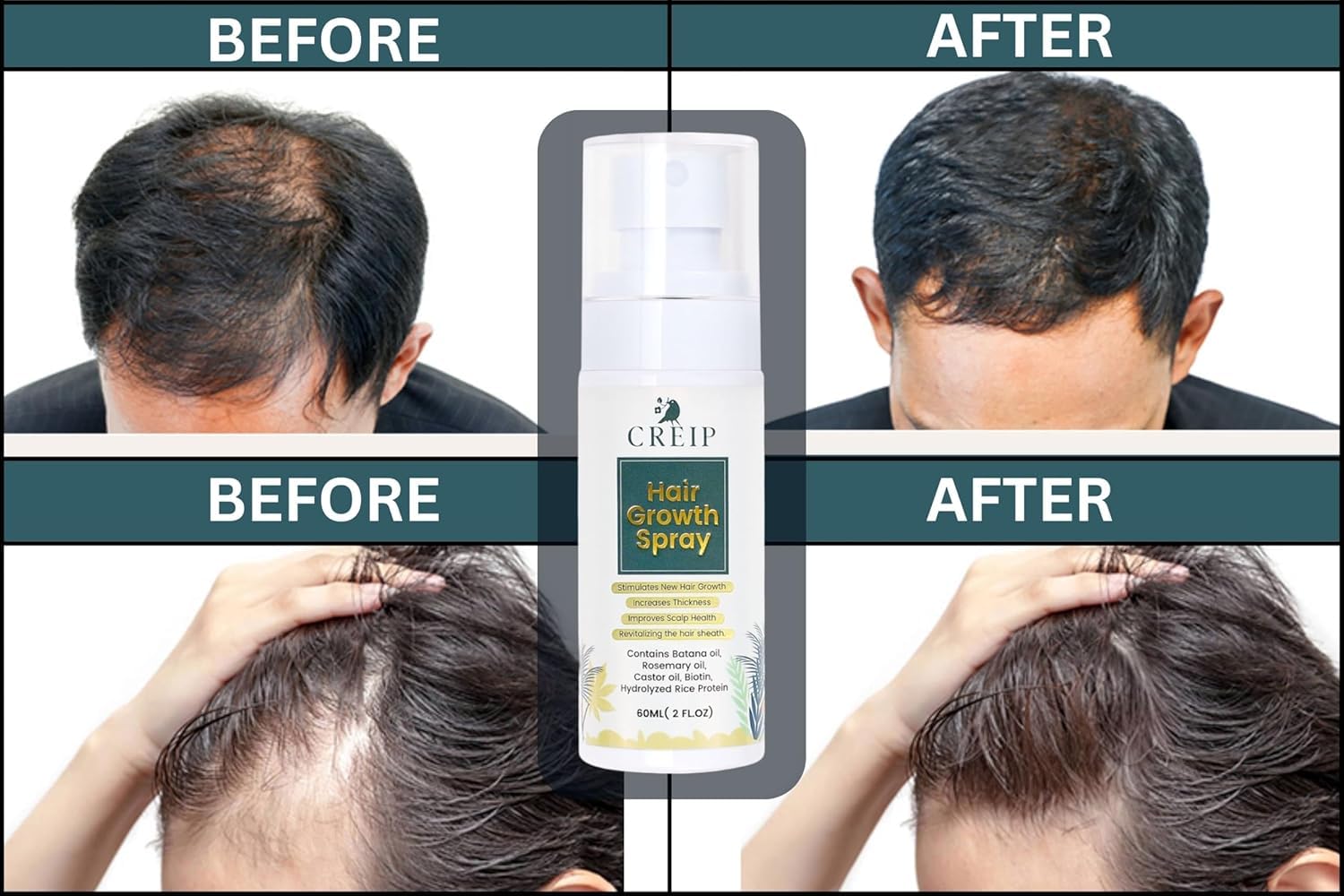 OG Hair Growth Spray, 2 FL OZ: Natural Formula with Batana, Castor and Rosemary Oil, Rice Water, and Biotin for Women and Men - Stimulates Hair Follicles & Promotes Hair Thickening
