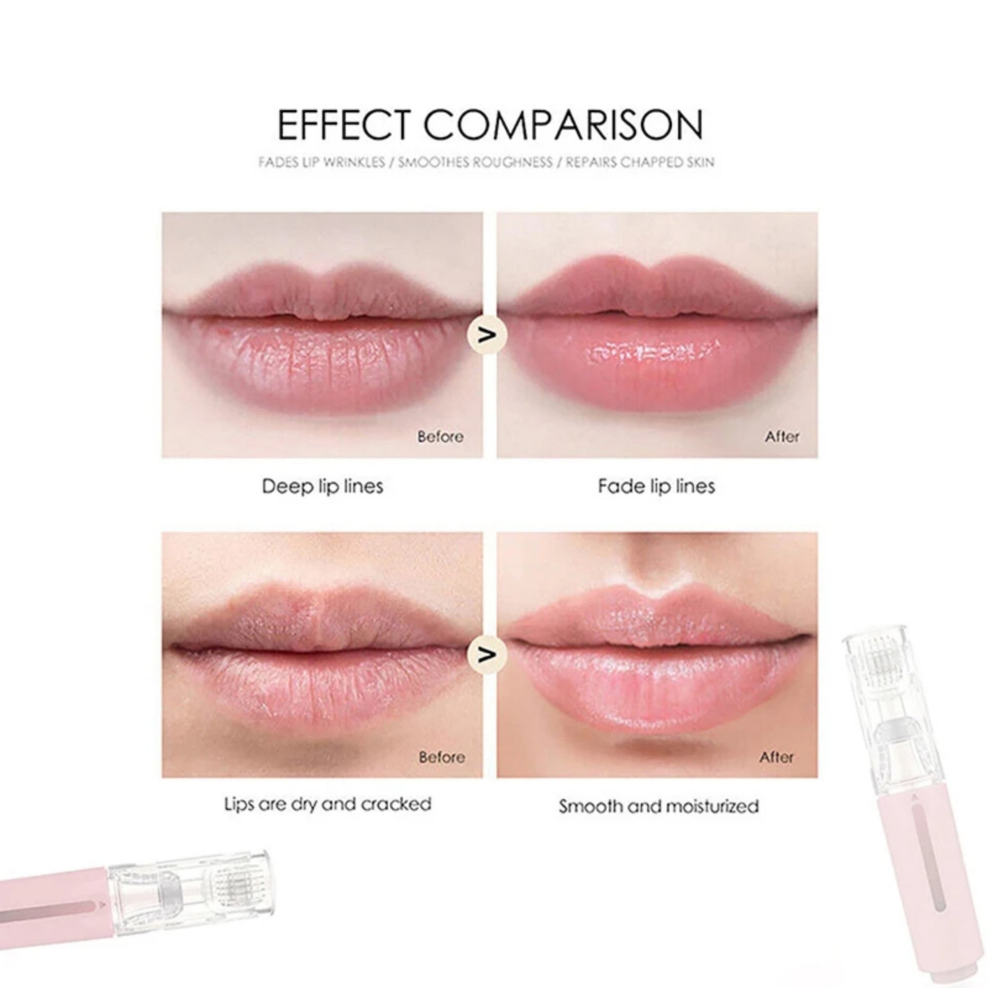 3 In 1 Lip Care Roller Needle Roller Lip Roller Beard Growth Roller Beard Hair Growth Roller Beard Treatment Serum Applicant - EZ Beauty Lashes