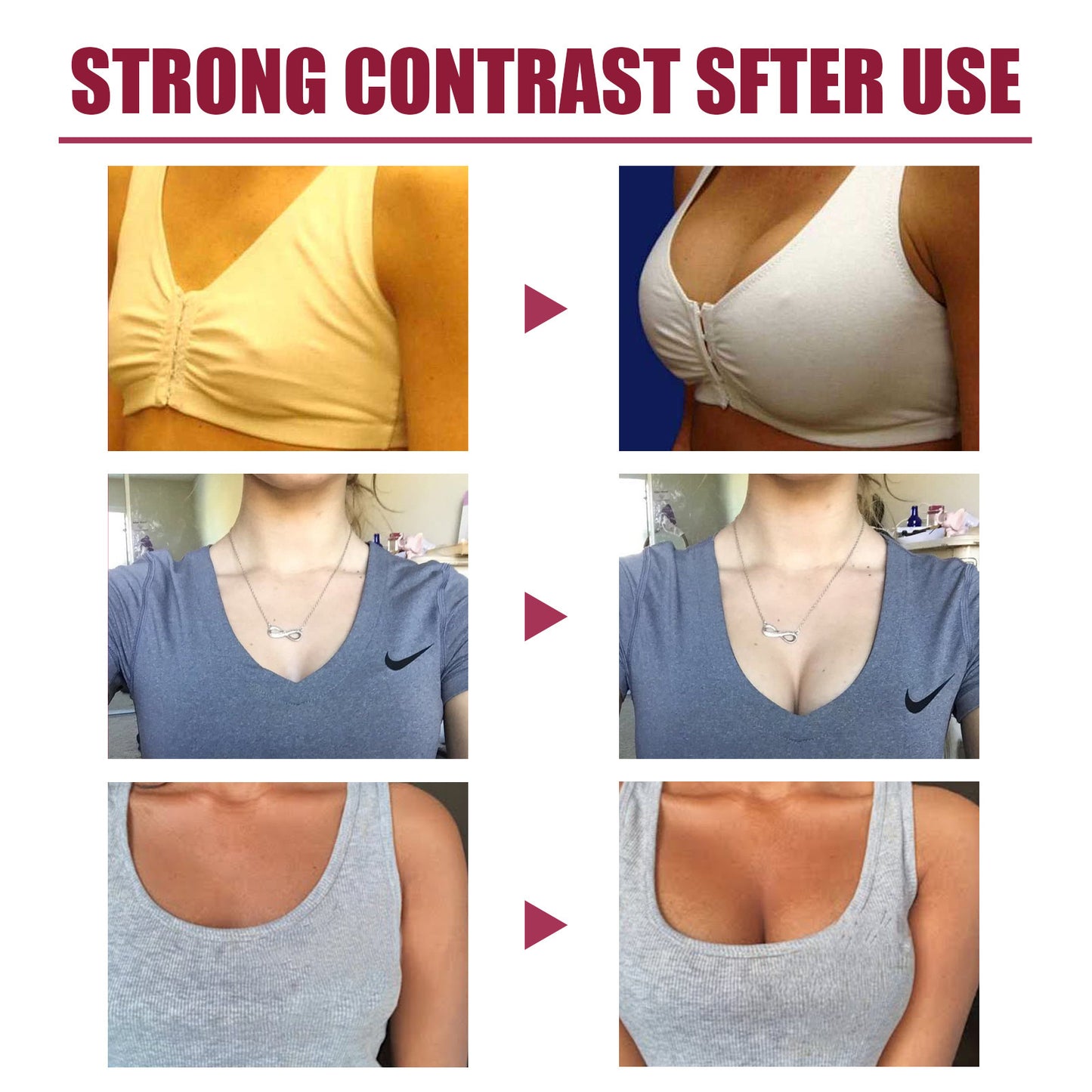 OUHOE Protein Chest Lifting & Firming Patch - EZ Beauty Lashes